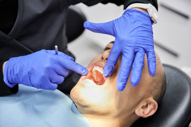 Best Emergency Dental Extractions in New Albany, IN
