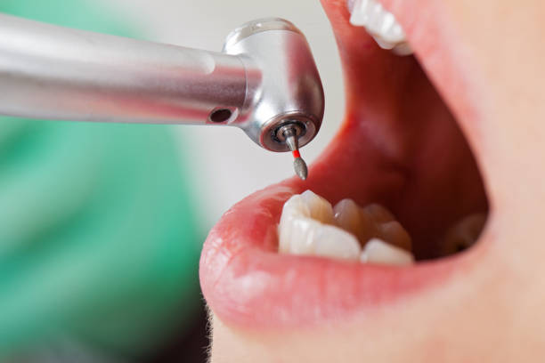 Best Emergency Dental Services for Seniors in New Albany, IN